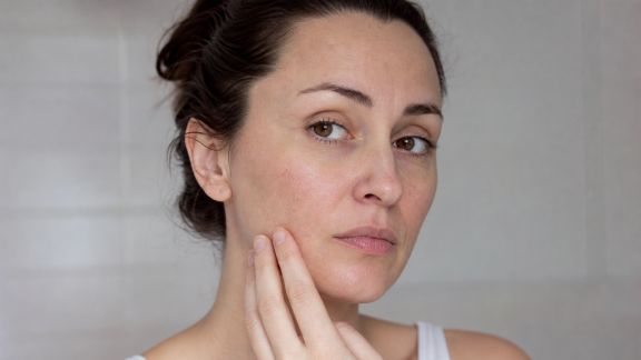 Peaux déshydratées : symptômes, causes et solutions ciblées