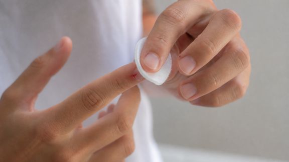 Prévenir et traiter les petits bobos cutanés du quotidien