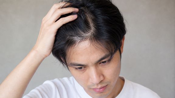 Les effets du stress sur la santé des cheveux et comment y remédier