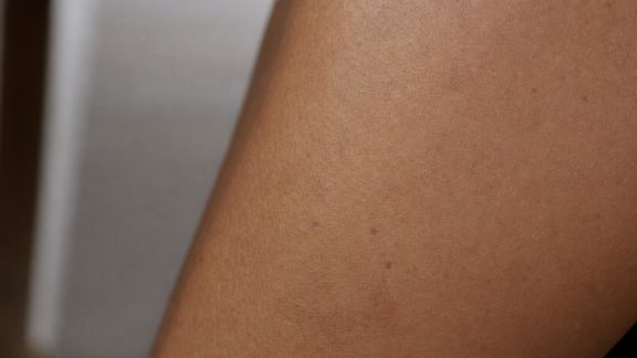 Comprendre l’importance du microbiome pour une peau saine
